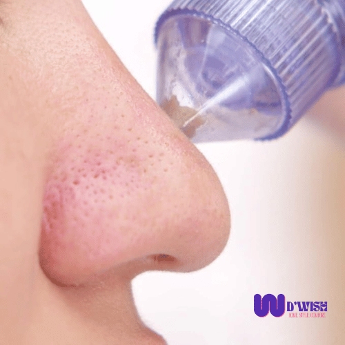 Acne, Blackhead, Whitehead, Sebum Extractor / Pore Cleaner / Wrinkle Eraser